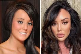 Channel 5’s Celebrities: What Happened To Your Face looks at Charlotte  Crosby’s history of plastic surgery