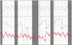 Polygraph Examinations Arizona Phoenix Private