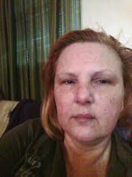 Faces of Chronic Pain