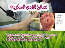 القدم السكري سبتمبر 2018