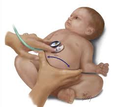 Image result for Succussion Splash