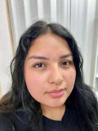 Ananateramicropigmentacion