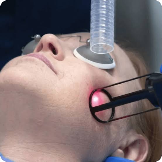 Laser Skin Resurfacing in Dubai - Skin Experts