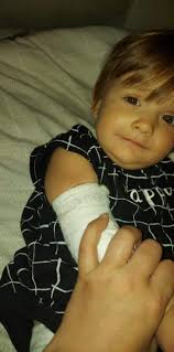 Hey mommas. My son is 9 months old and has hemophilia B. He has a broviac  line and the last 2 dressing changes it's looked irritated. He was  scratching it last week