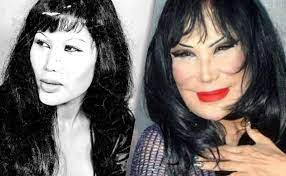Lyn may antes y después. Pagina 1 La Transformacion Del Rostro Lyn May En Las Ultimas Decadas Diario La Prensa
