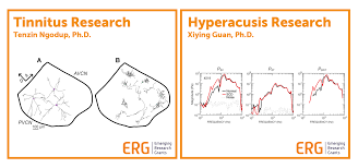 Previous tennitus louder after ear infection. Covid 19 And Hearing Loss Tinnitus And Vertigo Hearing Health Foundation