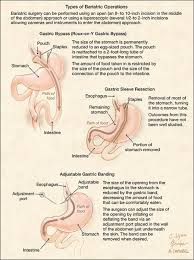 Pin On Medical Forum From Jama