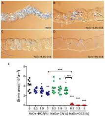 Garcinia Cambogia Extract Removes Calcium Oxalate Kidney Stones In Both Genetic And Non Genetic Drosophila Models Of Nephrolithiasis Biorxiv