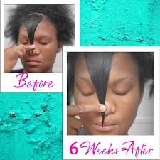 Natural Hair Biotin Before And After Pin By Clarise Lewis On Hair Natural And Otherwise Hair Regrowth Serums Hair Regrowth Vitamins For Hair Growth