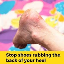 We did not find results for: How To Stop Shoes Rubbing The Back Of Your Heel Ankle Achilles
