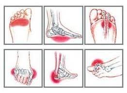 Maybe you would like to learn more about one of these? Foot Pain Diagram Why Does My Foot Hurt