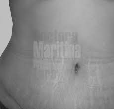 El Ombligo En La Abdominoplastia Doctora Martinez Lara
