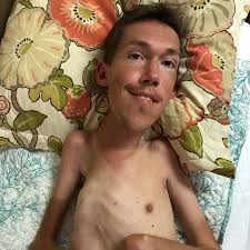 This Interabled Couple Rocks Their Love Life and Plans