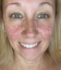 This is the kind of influence I LOVE seeing