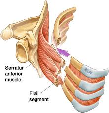 Image result for Flail Chest