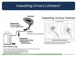 Urinary Catheter Types And Being Part Of The Insertion Team