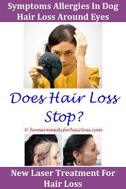 Ectoparasites like fleas and mange mites (demodectic mange) cushing's disease. Pin On Treat Hairloss