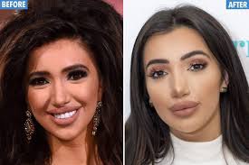 Maybe you would like to learn more about one of these? Selfies Make Your Nose Look 30 Per Cent Bigger So Is That Why These Stars Went Under The Knife