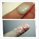 Perte blanche paisse - Aot 20- BabyCenter