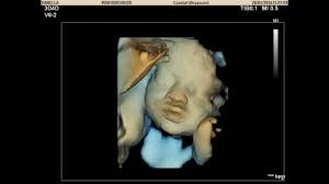 Coastal Ultrasound Welcome To Coastal Ultrasound Gisborne