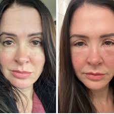 TOP 10 BEST Hair Removal in Waco, TX