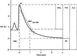 spirometry an overview sciencedirect topics