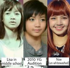 Lisa before BLACKPINK: these are her surgeries.