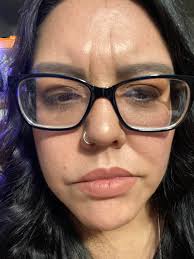 thank you everyone. I will look into all suggestions 😊 So my lines in  between my eyebrows are sooo bad and then by my mouth I have half my face  dropping