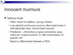 Image result for Venous Hum