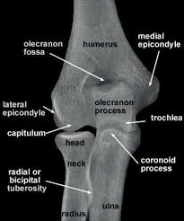Despite the name, tennis elbow does not tennis elbow is very easy to diagnose. Radiographs Of The Upper Limb Radiology Schools Radiology Student Medical Anatomy