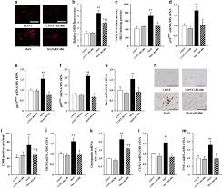 Nos coups de coeur sur les routes de france. Blockade Of Glucocorticoid Receptors With Ru486 Attenuates Cardiac Damage And Adipose Tissue Inflammation In A Rat Model Of Metabolic Syndrome Hypertension Research
