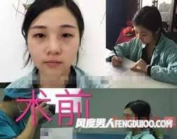 Cô gái 8 lần phẫu thuật để giống hệt Phạm Băng Băng