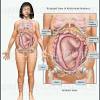 Female abdominal muscles are different from those of males because of their size, shape, and the different hormones that influence each sex, which also impact the size and shape. 3