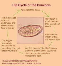 How To Treat Pinworms Your Most Common Questions Answered In 2020 How To Treat Pinworms Infographic Health Health Questions