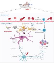 Image result for site:byggahus.se grus till infiltration
