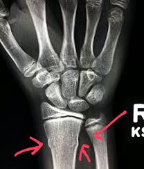 Check spelling or type a new query. Pin On Pediatric Radiology