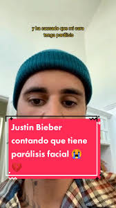 Justin Bieber enfrenta parálisis facial: un mensaje de apoyo