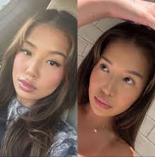 Masseter Muscle Women