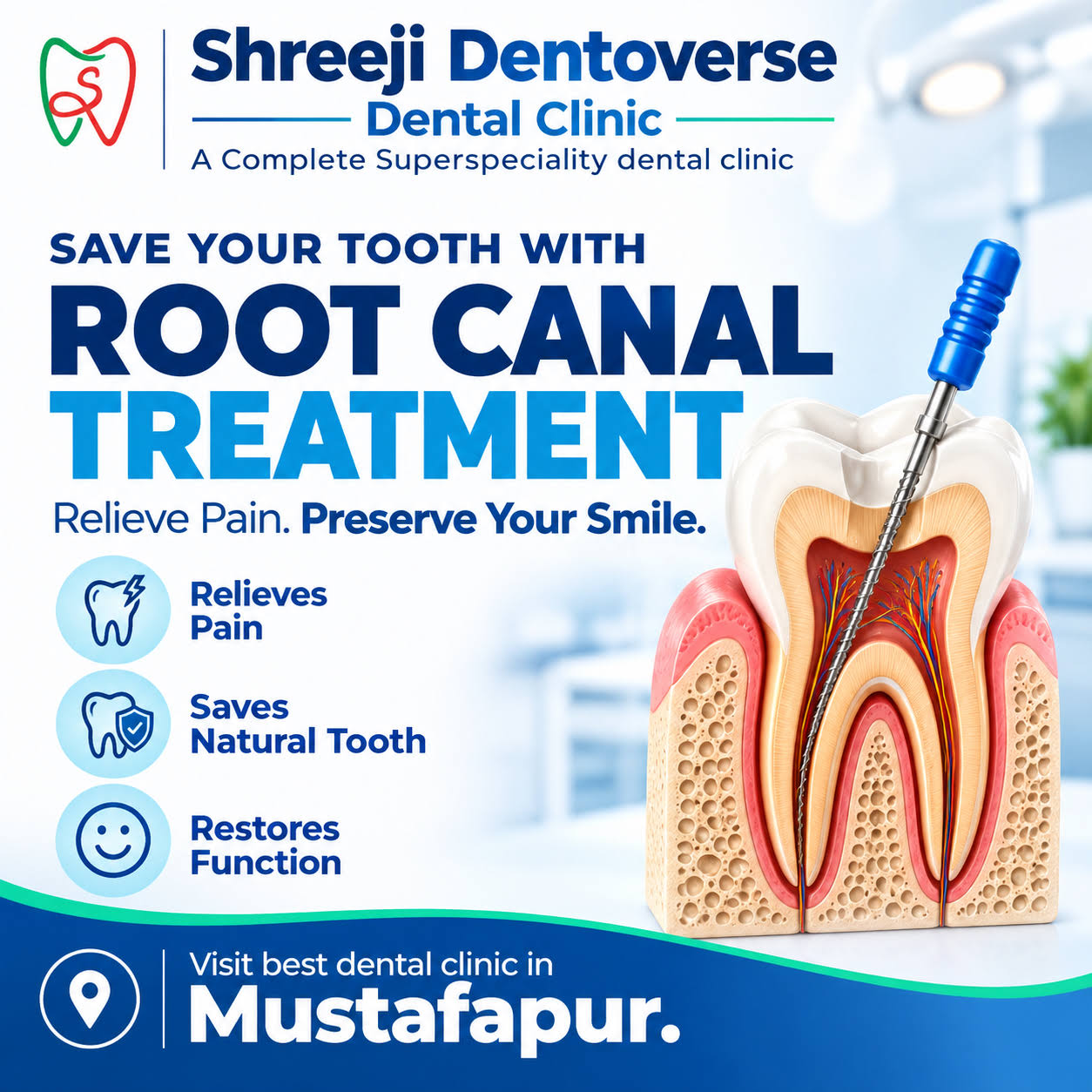 Root Canal Treatment (RCT) product image