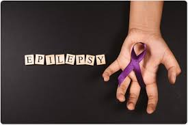 In addition to using diagnostic tests like mri, ct scans, eeg and emg, neurologists also employ neurological testing to gauge muscle strength and. Advancements In Epilepsy Treatment