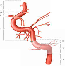 Erfahre hier mehr über ihre anatomie, verlauf & klinik! Arteria Carotis Interna Ars Neurochirurgica