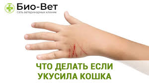 Ukusila Koshka Chto Delat I Chem Opasno Set Vetklinik Bio Vet Youtube