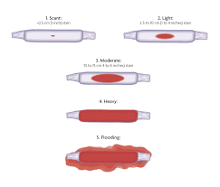 However, from 6 weeks, it's likely larger clots will be visible. Medical Abortion Up To 10 Weeks Bpas