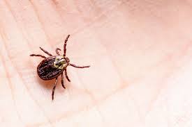 This is also the best way to. Tick Removal How To Remove A Tick Safely