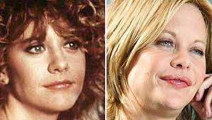 Let's be real… she's small, she had (a not needed) plastic surgery when she was only 22, and her legs are not the longest in the industry. 7 Celebrities Who Look Worse After Plastic Surgery Cosmeticium