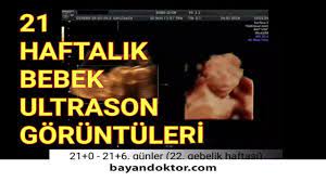 21 hafta gebelik hafta hafta hamilelik hamilelik doktorlar hafiz