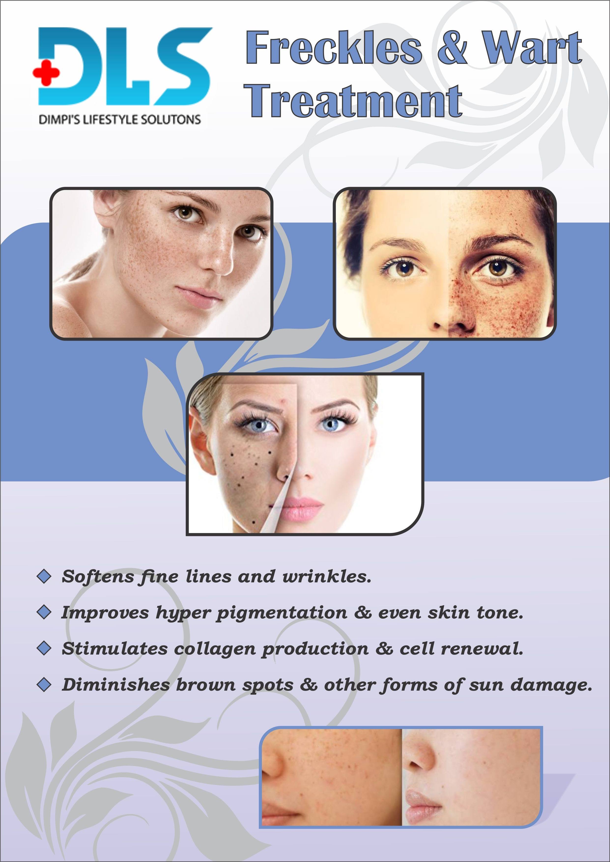 Freckles & wart treatment product image