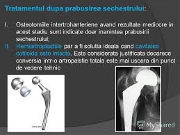 Cartilaj de rechin ajuta in osteoporoza, artroze, retinopatie diabetica, terapia cu citostatice, imunodepresii. Artroza De Tratament Cu SodÄ Tratament Cu SodÄ Pentru ArtrozÄ Cele Mai Frecvente Dureri La Persoanele In VarstÄ