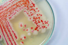 Pink mold may not be a traditional mold like white mold, red mold, green mold, or other kind, but it does have similar growth qualities and health concerns. Pink Mold Is It Dangerous And How To Get Rid Of It