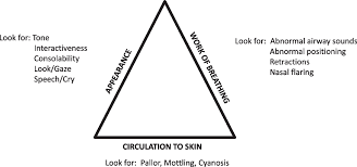 Image result for Pediatric Assessment Triangle